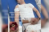 Астанадағы саябақта сұмдық: Ер адам жасөспірімді аяусыз соққыға жықты