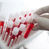 Талдықорғанда науқасқа басқа топтың қанын құйған дәрігерлерді тексеру басталды