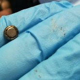 Батарейку изъяли из носа двухлетнего ребенка врачи в Актау