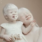 Альбинизмге шалдыққан арулардың арманы...