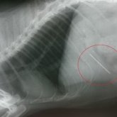 «16 жыл бойы әйелдің құрсағында ине болған»: бәрі қайғылы аяқталуы мүмкін еді