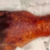 Иті сілекейін шұбыртқандықтан қожайыны өліп кетті