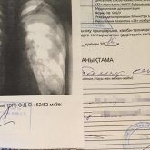 086/у медициналық анықтамасын eGov арқылы алуға болады