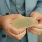 «Төсім өмірімді құртты»: омырауын кішірейтуді армандайтын келіншек ақшалай көмек сұрайды