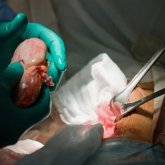 Президент қол қойды: Қазақстанда мәйіттің сау органы қызу саудаға түсуі мүмкін