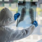 «Ескеріп жатқан ешкім жоқ»: елордалық рентген-зертханашылар өздеріне үстемақы төленбегеніне наразы