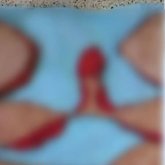 Қазақстанда пластикалық хирургтар кесілген дене мүшелерін жарнамалап жүр (ВИДЕО)