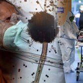 Үнді штамынан денеде қара зең пайда болуы мүмкін бе?