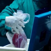 Елімізде түрмеде отырған азамат өзінің ұлына бүйрегін берді