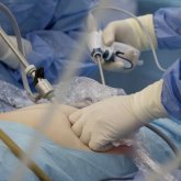 Жатырына ота жасату кезінде әйелдің бүйрегі ұрланған