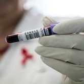 Алматыдағы орталық ауруханаға түскен 5 науқас ем алу кезінде ВИЧ жұқтырған