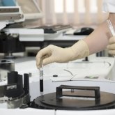 Алматыда ВИЧ тараған ауруханада эпидемиологиялық тергеу басталды – министр