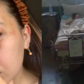 Қызылордада жүкті әйел полицияда жұмыс істеген күйеуінің соққысынан кейін мүгедек болып қалған