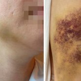 Ақсу кәсіпорнының директоры әйелін көкала қойдай етіп сабап тастаған (ФОТО)