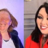 «25 жыл бойы тіссіз жүрген»: Адам танымастай өзгерген әйел желідегілерді тәнті етті