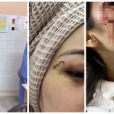 «Шабынан теуіп, кеудесін тістеп алған»: Тағы бір науқас дәрігерлерге шабуыл жасады (ВИДЕО)