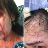 «Басымды жарды»: Атыраулық әйел депутат болған экс-күйеуінің зорлық-зомбылық жасағанын айтты