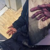 Алматы облысында оқушылар сыныптасын соққыға жығып, жансақтау бөліміне түсірген