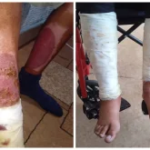 Қарағандыда жасөспірім қатарласына сіріңке лақтырып, өртеп жібермек болған