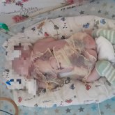 Семейде жаңа туған нәресте перзентханада күйіп қалды (ФОТО)