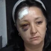 «Қолы сынып, басы жарылған»: Алматыда 45 жастағы әйелді құдасы көшеде аяусыз ұрып кеткен