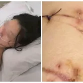 «Силикон көкірегі сақтап қалған»: Әйел 22 рет жасалған пышақ жарақатынан аман қалды