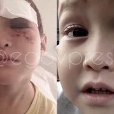 «Көз жанарынан айырылған»: Оралдағы спорт мектебінде 5 жасар бала мүгедек болып қалды