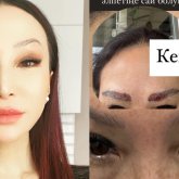 «Желкем тас болып, қасым ісіп кетті»: Тележурналист Жанар Байсеміз трансплантация жасатты (ФОТО)