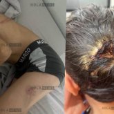 «Денесін күйдіріп, саусақтарын сындырды»: «Қазақмыс» қызметкері 8 жастағы баланы азаптаған (ФОТО)