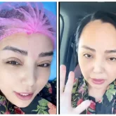 «Көзімді жіппен тіктірдім»: Алтынай Жорабаева блефаропластика жасап тұратынын мойындады