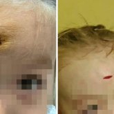 «Қолынан қатты тартқан»: Алматыда балабақша тәрбиешісі баланың маңдайын жарып жіберген