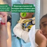 Меркі ауруханасында дау: «Қан аламыз» деп кішкентай баланың қолын сындырған