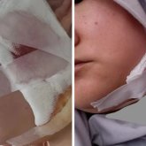 Бетін тескен: Ақтаулық әйел тіс жұлдырамын деп, соңында ота жасатуға мәжбүр болған