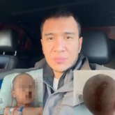 Атырауда балабақшада үш жасар бала ауыр жарақат алды: Ата-аналар қауіпсіздікке алаңдаулы