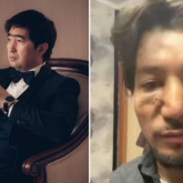 «Күрделі ота жасалмақ»: Мұқасан Шахзадаев соққыға жыққан әншінің жағдайы ауыр