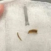 Ақтауда 11 айлық сәбидің өкпесінен металл табылды