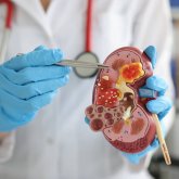 Түркістан тұрғыны бүйрегін 13 миллион теңгеге сатпақ болған