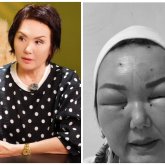 «Осымен бәрі бітті деп ойладым»: Өлім аузынан қалған блогер жан сырын ақтарды