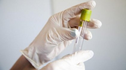 Ақтөбеде оқушыдан менингокок инфекциясы табылды