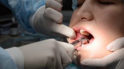 Ақтөбе тұрғыны ақыл тісін жұлдырамын деп өліп қала жаздаған
