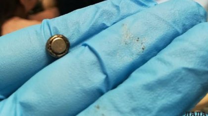 Батарейку изъяли из носа двухлетнего ребенка врачи в Актау