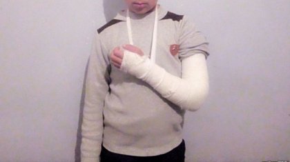 Учитель сломал руку пятикласснику в Узбекистане