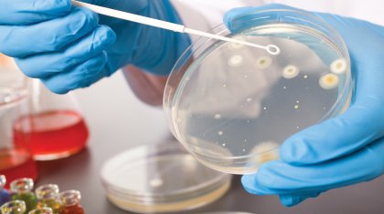 Қатерлі ісікке шалдықтырады: үйде сақтауға болмайтын 5 нәрсе