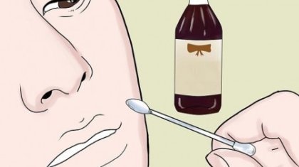 Ұшықты қалай тез кетіруге болады?