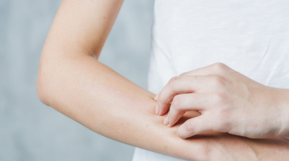 Құрғақ тері күтімді қажет етеді