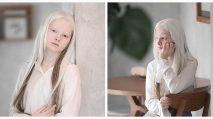 «Періште сияқты»: 11 жастағы қыз әлемді таңқалдырды