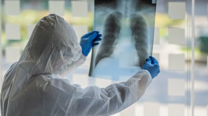 «Ескеріп жатқан ешкім жоқ»: елордалық рентген-зертханашылар өздеріне үстемақы төленбегеніне наразы