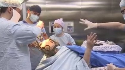 Елордада дәрігерлер науқасқа наркозсыз операция жасаған