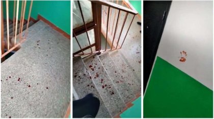 «Жыныс мүшесін кесіп тастаған»: БҚО полициясы желіде тараған ақпаратқа түсініктеме берді