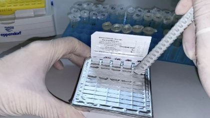 Елімізге маймыл шешегін анықтауға арналған тест жеткізілді